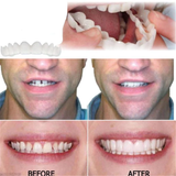 Fake Teeth - Snap-On Smile - Fake Teeth Veneers
