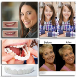 Fake Teeth - Snap-On Smile - Fake Teeth Veneers