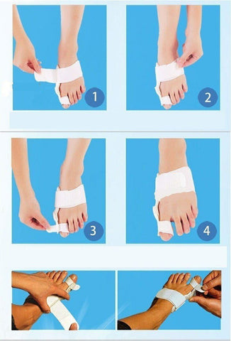 Bunion Corrector - Orthopedic Bunion Corrector