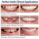 Fake Teeth - Snap-On Smile - Fake Teeth Veneers